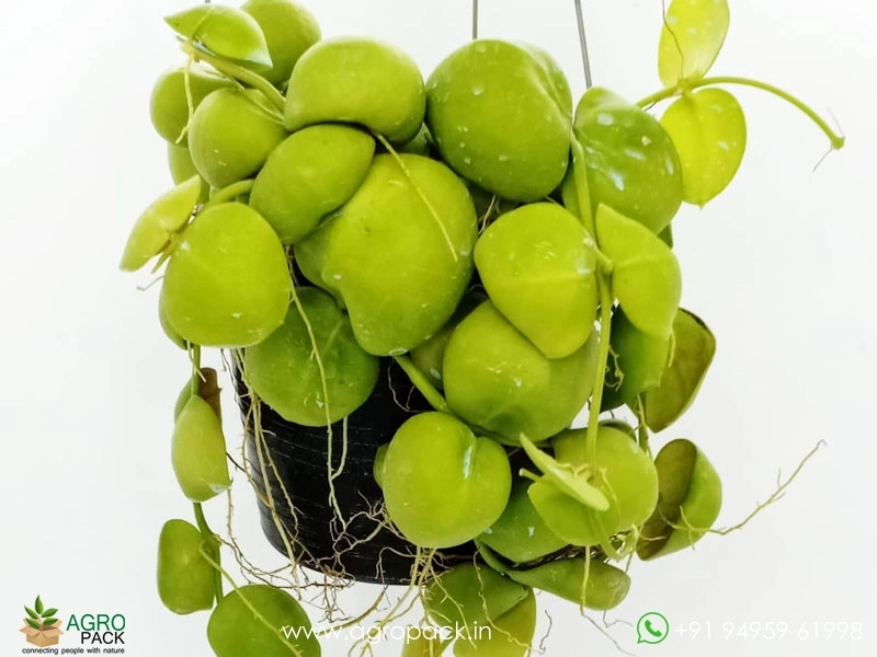 Kidney5